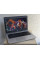 Уцінка! Ноутбук Б/В HP ProBook 430 G4:13, Intel Core i5 7200U, 8 GB DDR4, Intel HD Graphics, SSD 128Gb
